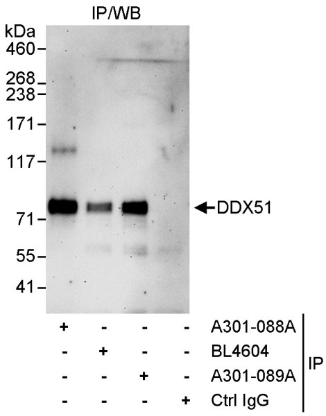 Anti-DDX51