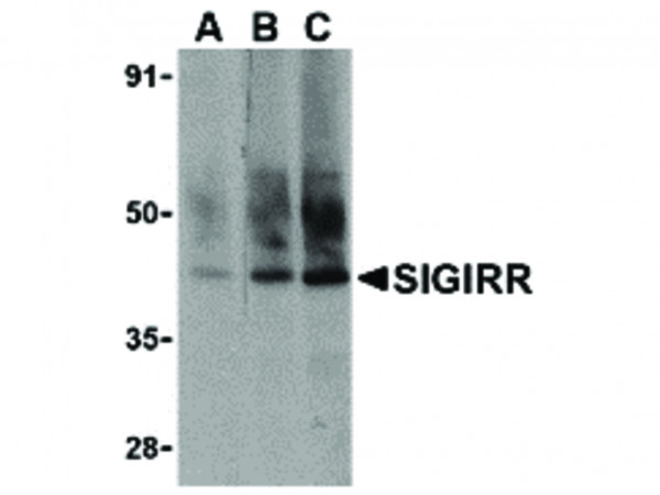 Anti-SIGIRR