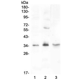 Anti-Fibroblast Growth Factor 23 / FGF-23
