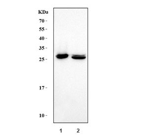 Anti-Carbonic Anhydrase I