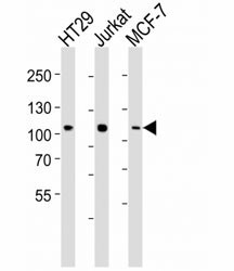 Anti-TPX2 (p100), clone 19AT953.286.93