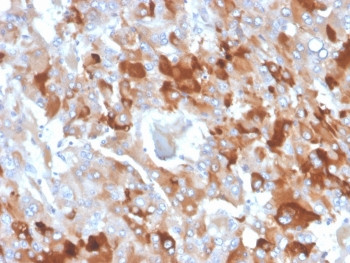 Anti-Clusterin / Apolipoprotein J / APO-J, clone CLU/4727