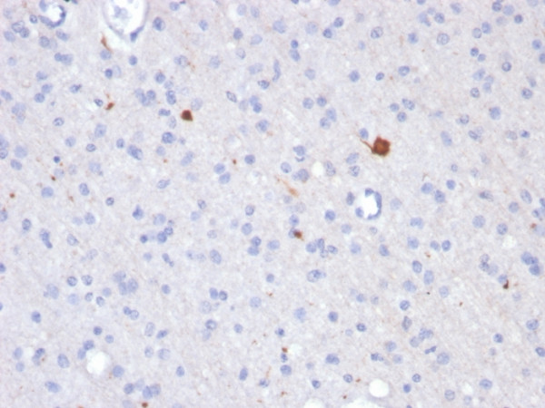 Anti-beta Amyloid, clone APP/3343