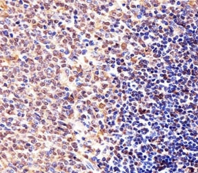 Anti-Cyclin B1 (CCNB1)