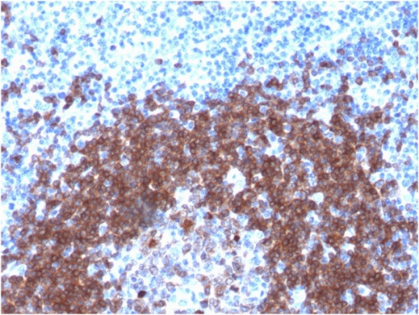 Anti-CD79a (B-Cell Marker), recombinant antibody, clone IGA/1790R