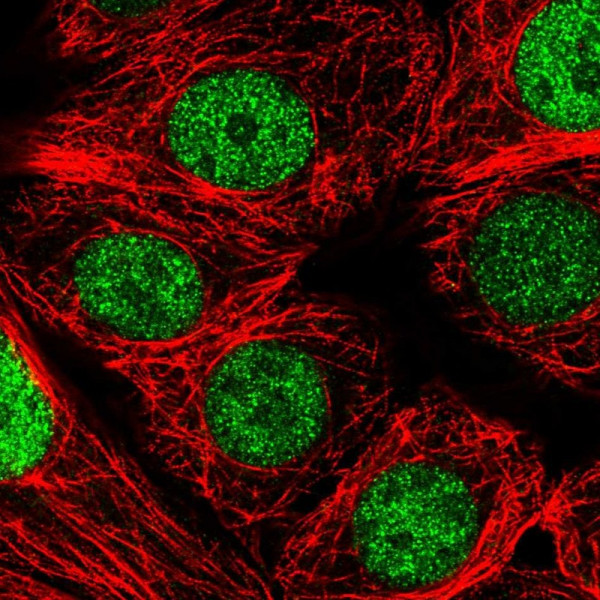 Anti-NCBP2
