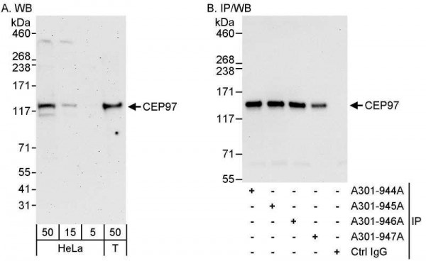 Anti-CEP97