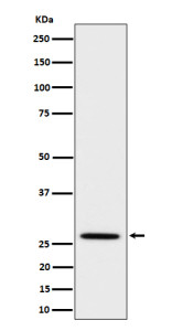 Anti-Adipoq / Adiponectin, clone 30A64