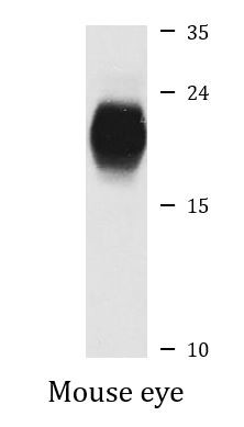 Anti-beta Crystallin S