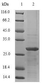 Thyrotropin subunit beta (TSHB), human, recombinant