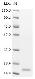 Bromodomain-containing protein 2 (BRD2), partial, recombinant human