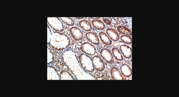 Anti-ATM (1D1), monoclonal