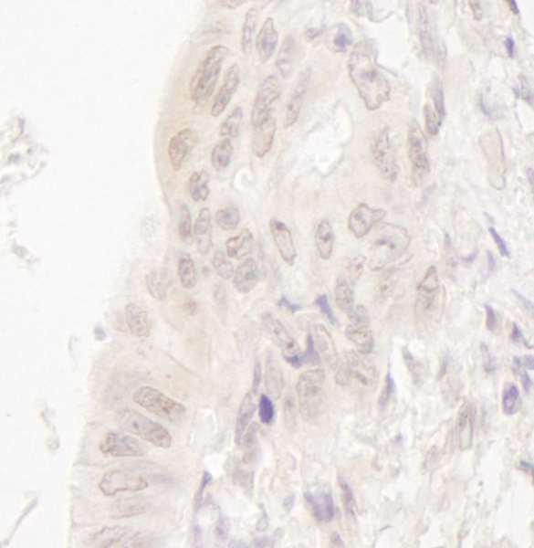 Anti-CASC5 (IHC)