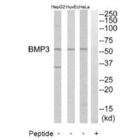 Anti-BMP3