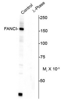 Anti-phospho-FANCI (Ser556)