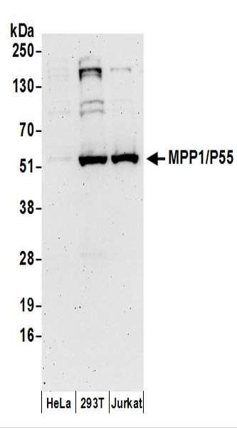 Anti-MPP1/P55