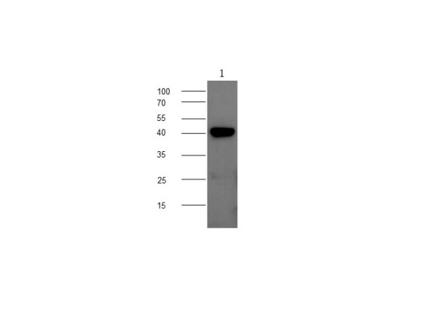 Anti-CHI3L1