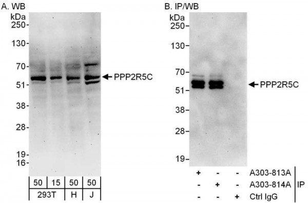 Anti-PPP2R5C