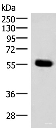 Anti-IPPK