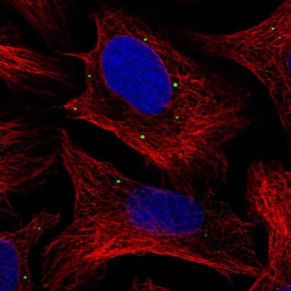 Anti-NUDT5