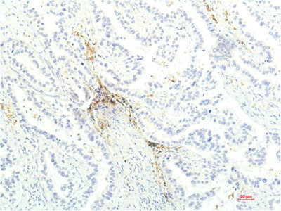 Anti-JAK1 Monoclonal