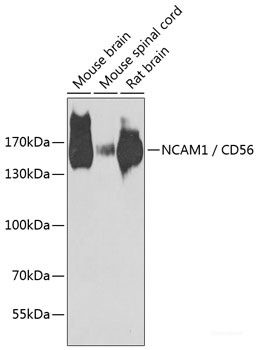 Anti-CD56