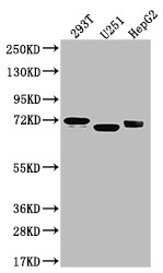 Anti-SLC6A4 Recombinant Monoclonal, clone 9G3