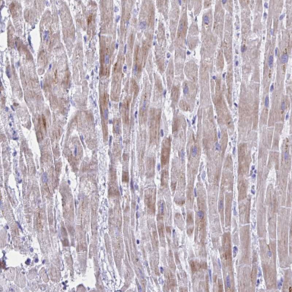 Anti-BCL6B