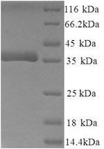 Decorin (Dcn), partial, mouse, recombinant