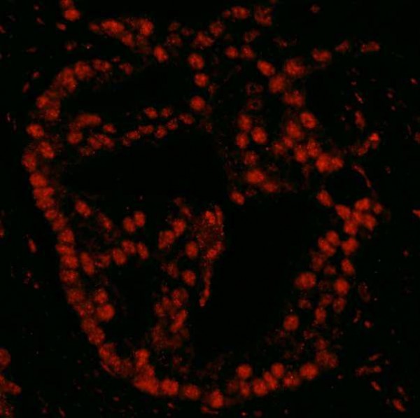 Anti-Pds5B (IHC)