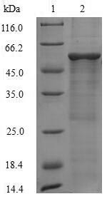 60S acidic ribosomal protein P0 (Rplp0), mouse, recombinant