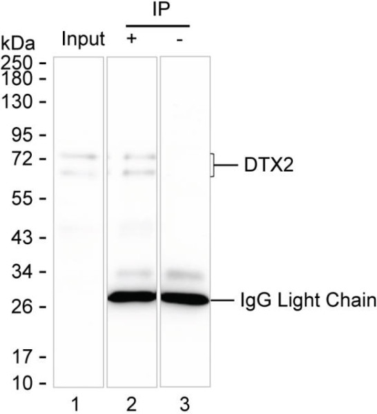 Anti-DTX2