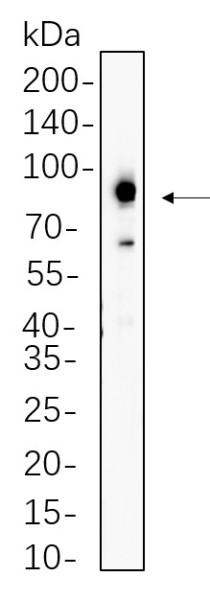 Anti-Recombinant Prostate Specific Membrane Antigen (PSMA), clone 3G11