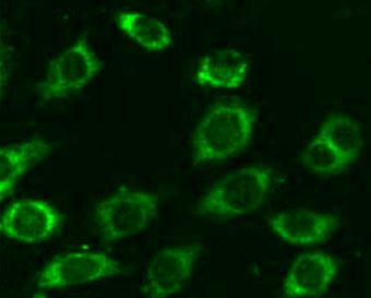 Anti-TCIRG1