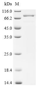 Adipocyte plasma membrane-associated protein (APMAP), partial, recombinant human
