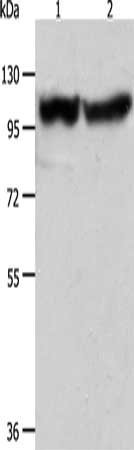 Anti-ACTN3
