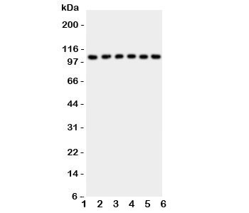 Anti-NFKB1 NF-kB p105/p50