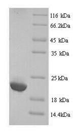 Immunoglobulin lambda-like polypeptide 5 (IGLL5), human, recombinant