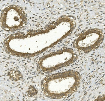 Anti-NRF-2 / NRF2L2