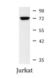 Anti-ZAP70, clone 4B2-C1-H3