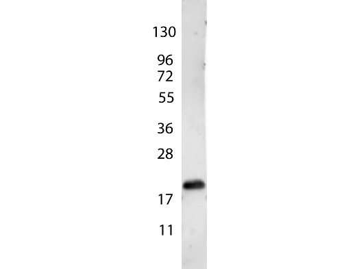 Anti-Vascular Endothelial Growth Factor-165 (VEGF-165)