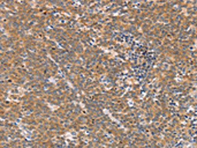 Anti-CD2AP