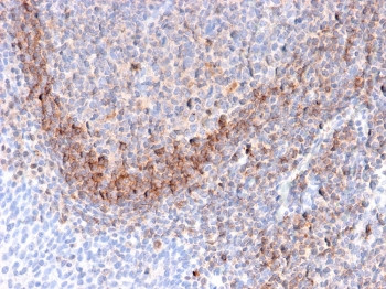 Anti-CD79b, clone B29/123