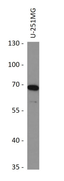 Anti-Serotonin Transporter