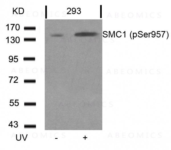 Anti-phospho-SMC1 (Ser957)