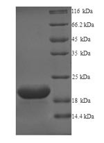 Probable G-protein coupled receptor 75 (GPR75), partial, human, recombinant