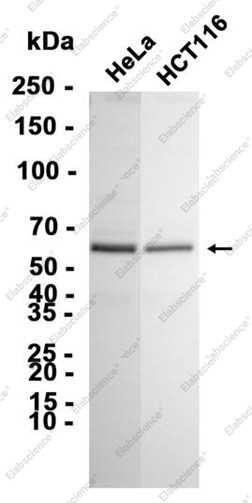 Anti-Recombinant PFKFB3, clone C112998