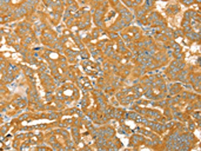 Anti-PTPN22