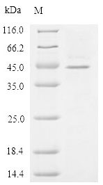 Zona pellucida sperm-binding protein 3 (ZP3), partial, human, recombinant