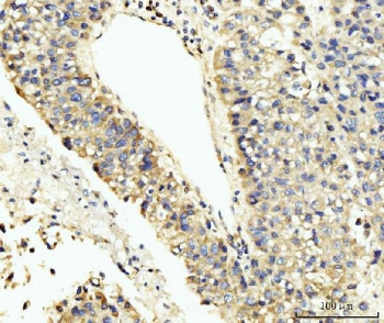 Anti-LARP4B / La-related protein 4B